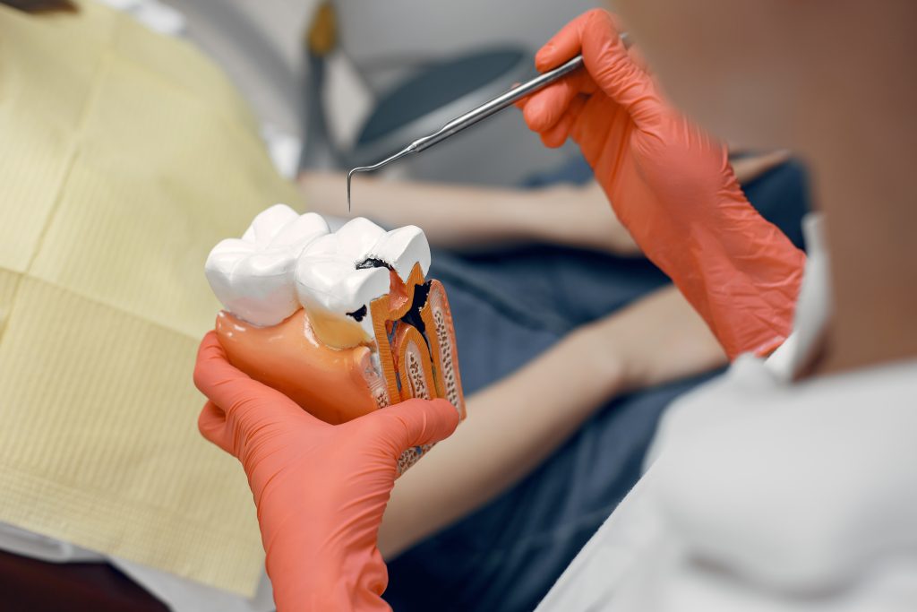 Endodonzia nel nostro studio dentistico desio