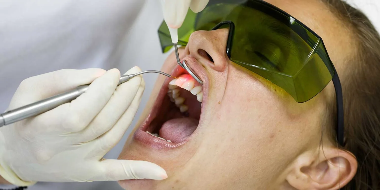 Laser odontoiatrico durante un trattamento